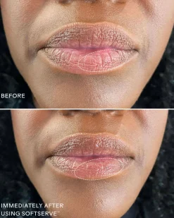 SoftServe Lip Treatment