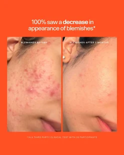 SOS Daily Rescue Spray Duo