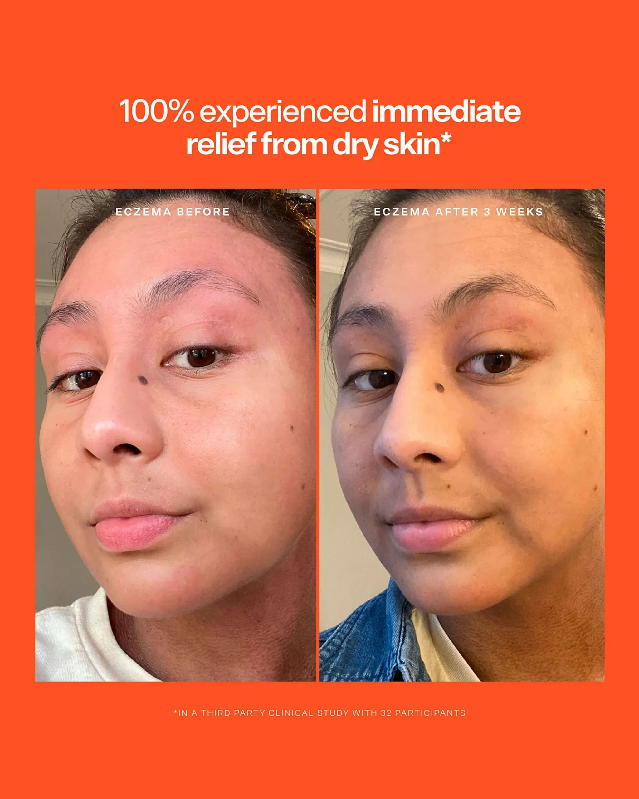 SOS Intensive Rescue Serum