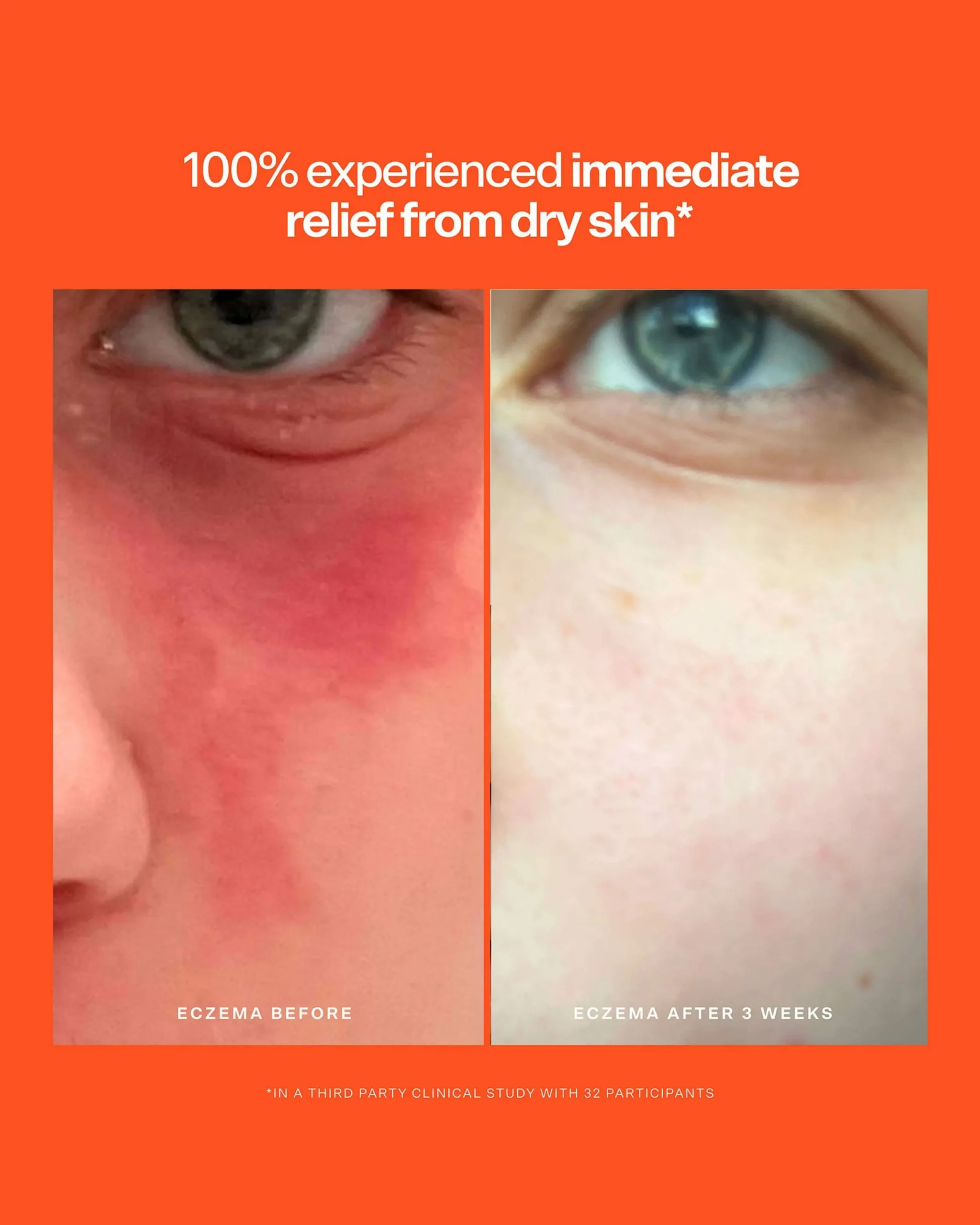 SOS Intensive Rescue Serum