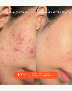 SOS (Save. Our. Skin) Daily Rescue Facial Spray with Hypochlorous Acid