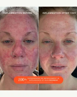 SOS (Save. Our. Skin) Daily Rescue Facial Spray with Hypochlorous Acid