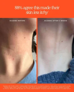 SOS Rescue + Relief Body Wash Treatment
