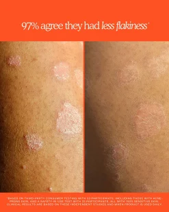 SOS Rescue + Relief Body Wash Treatment