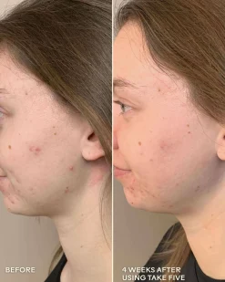 Take Five Hypochlorous Acid Balancing Body + Face Spray