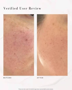 The Advanced Response Complex Face | Neck Cream
