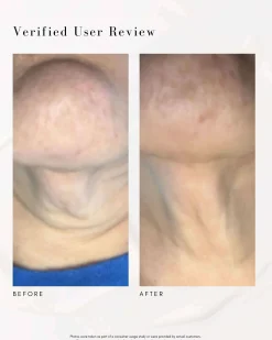 The Advanced Response Complex Face | Neck Cream