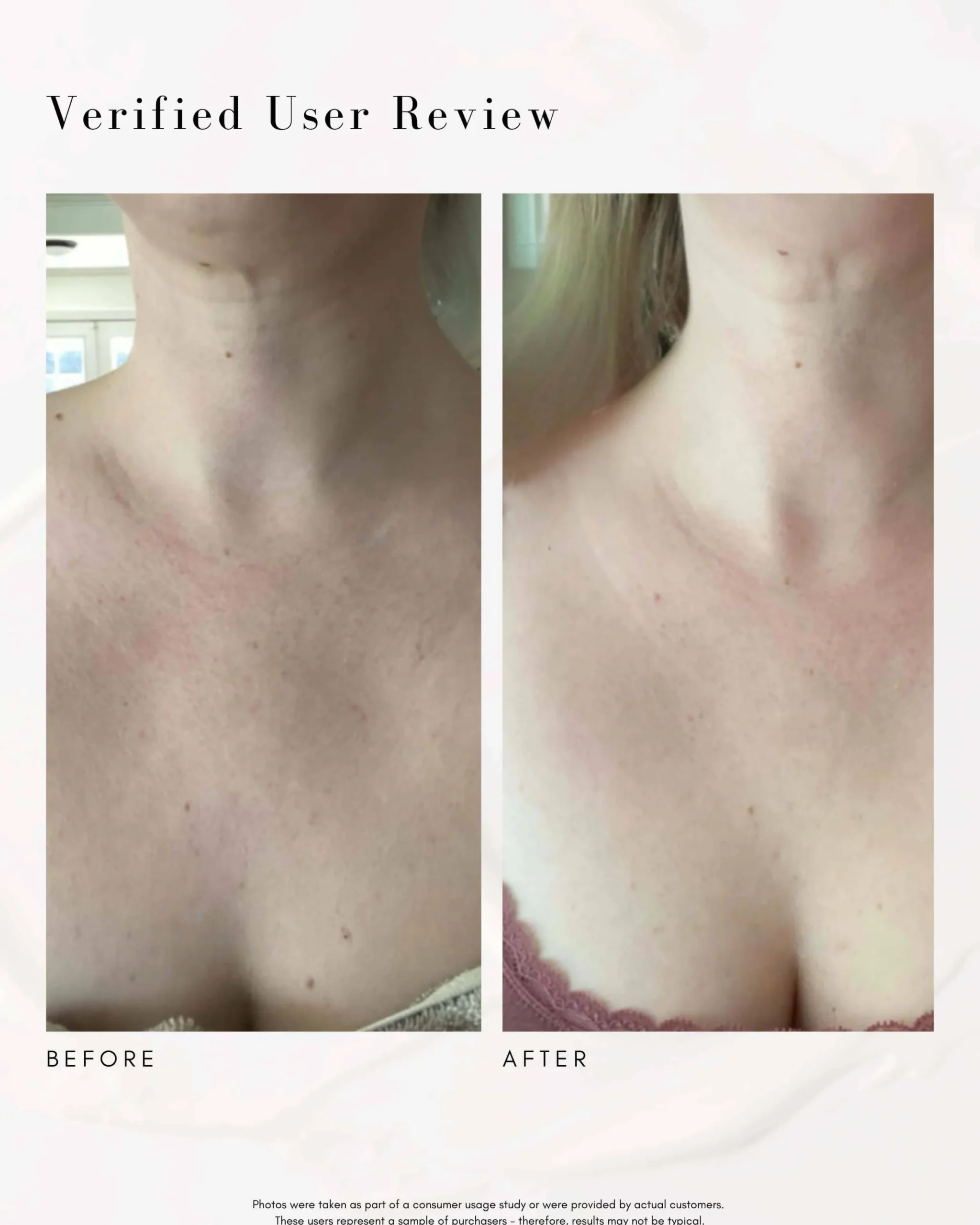 The Advanced Response Complex Face | Neck Cream