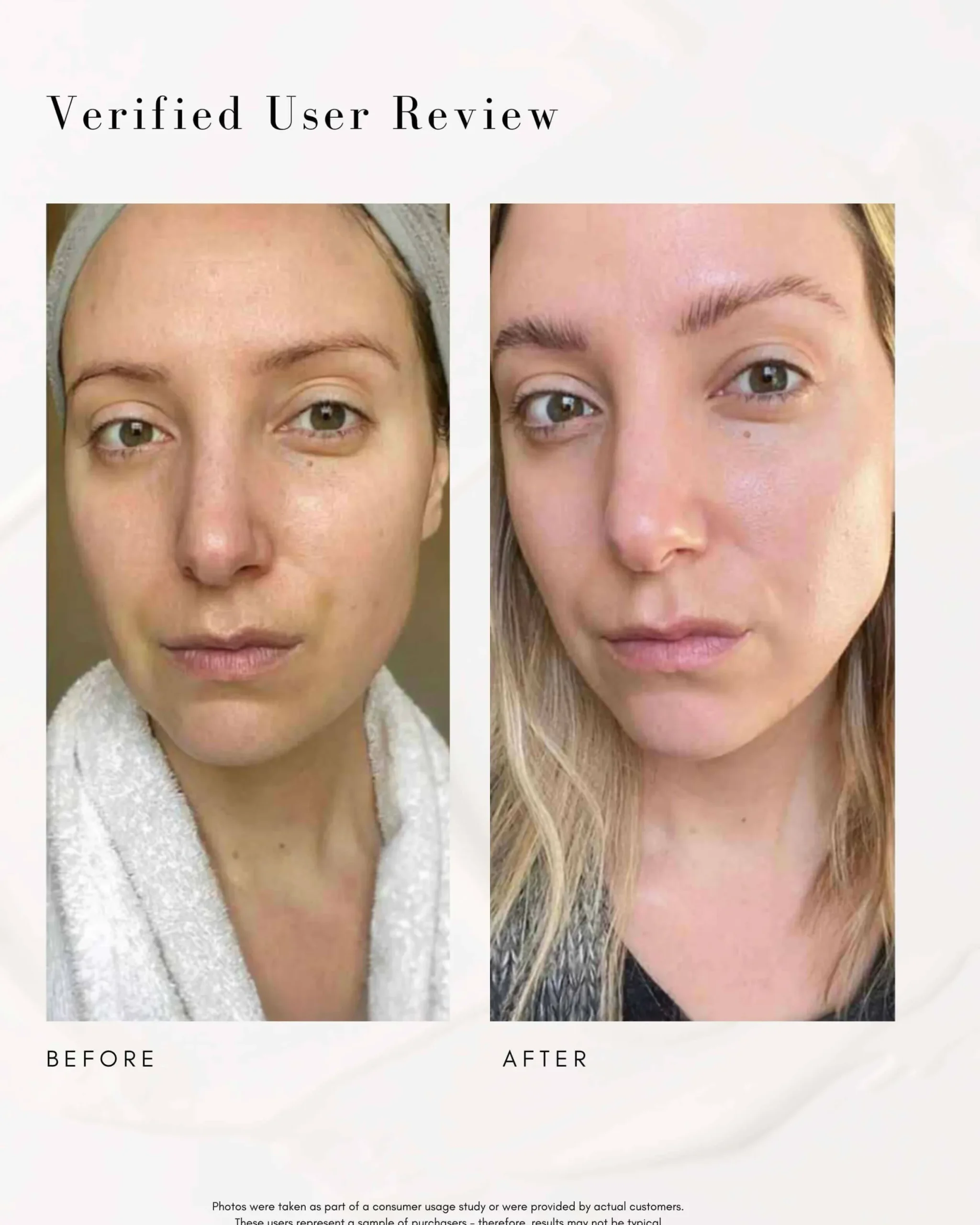 The Straight A Advanced Gentle Retinol Serum