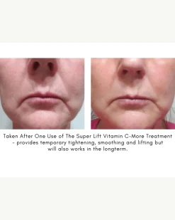 The Super Lift Vitamin C-More Treatment