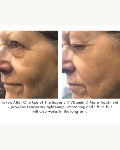 The Super Lift Vitamin C-More Treatment