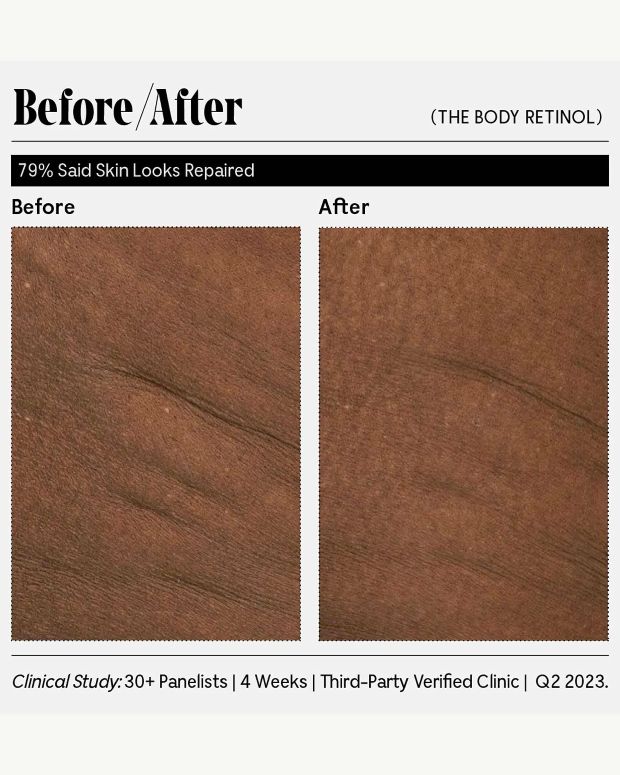 The Body Retinol