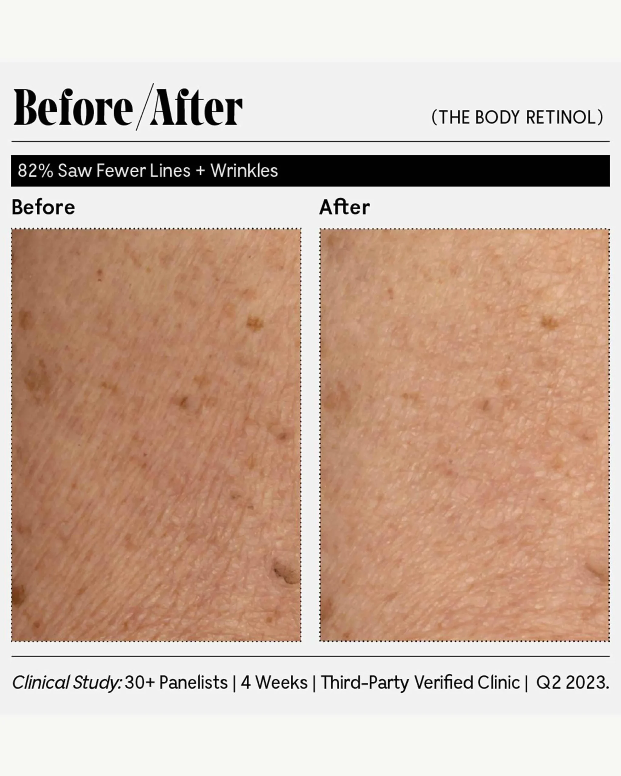 The Body Retinol