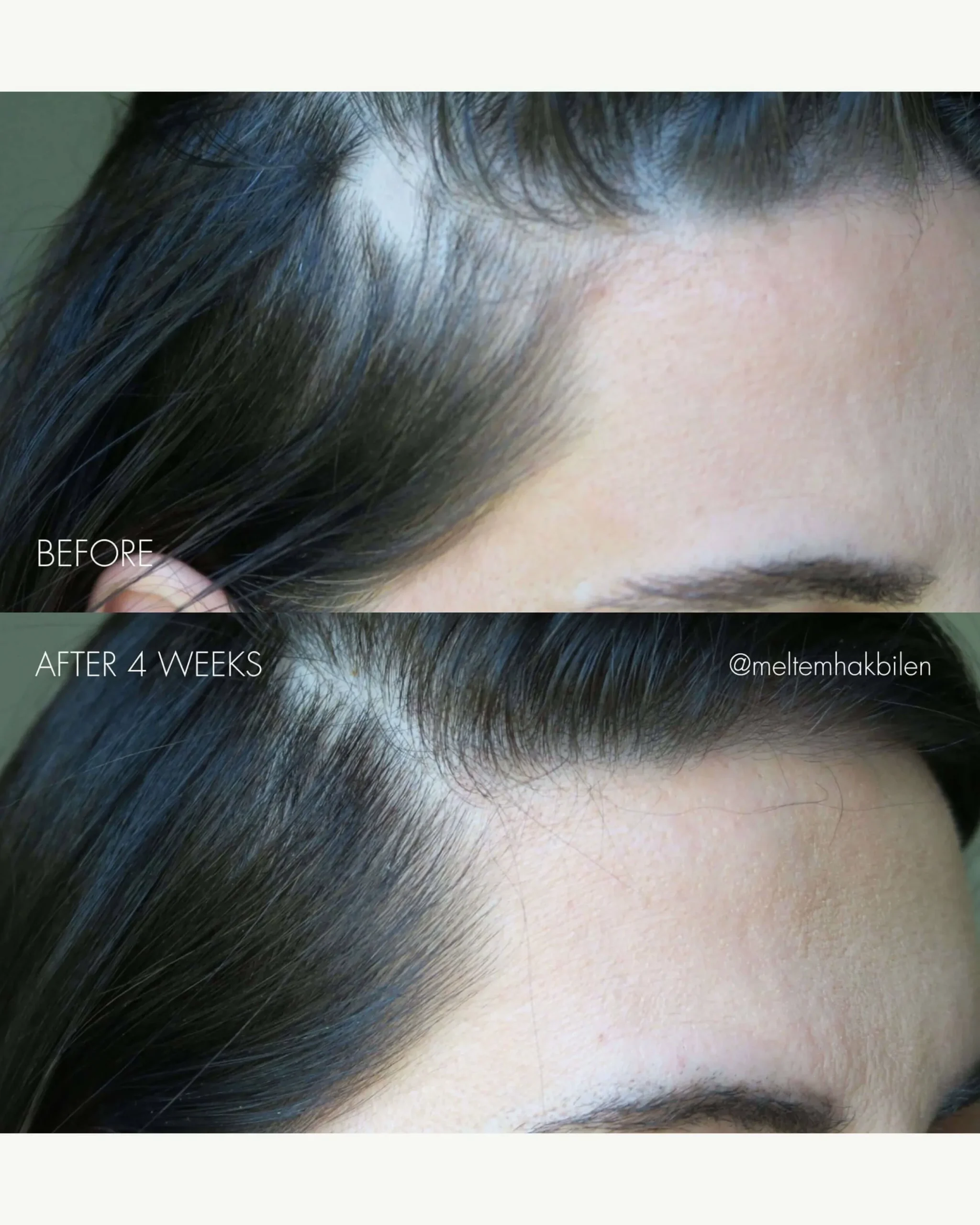 The Hair Serum