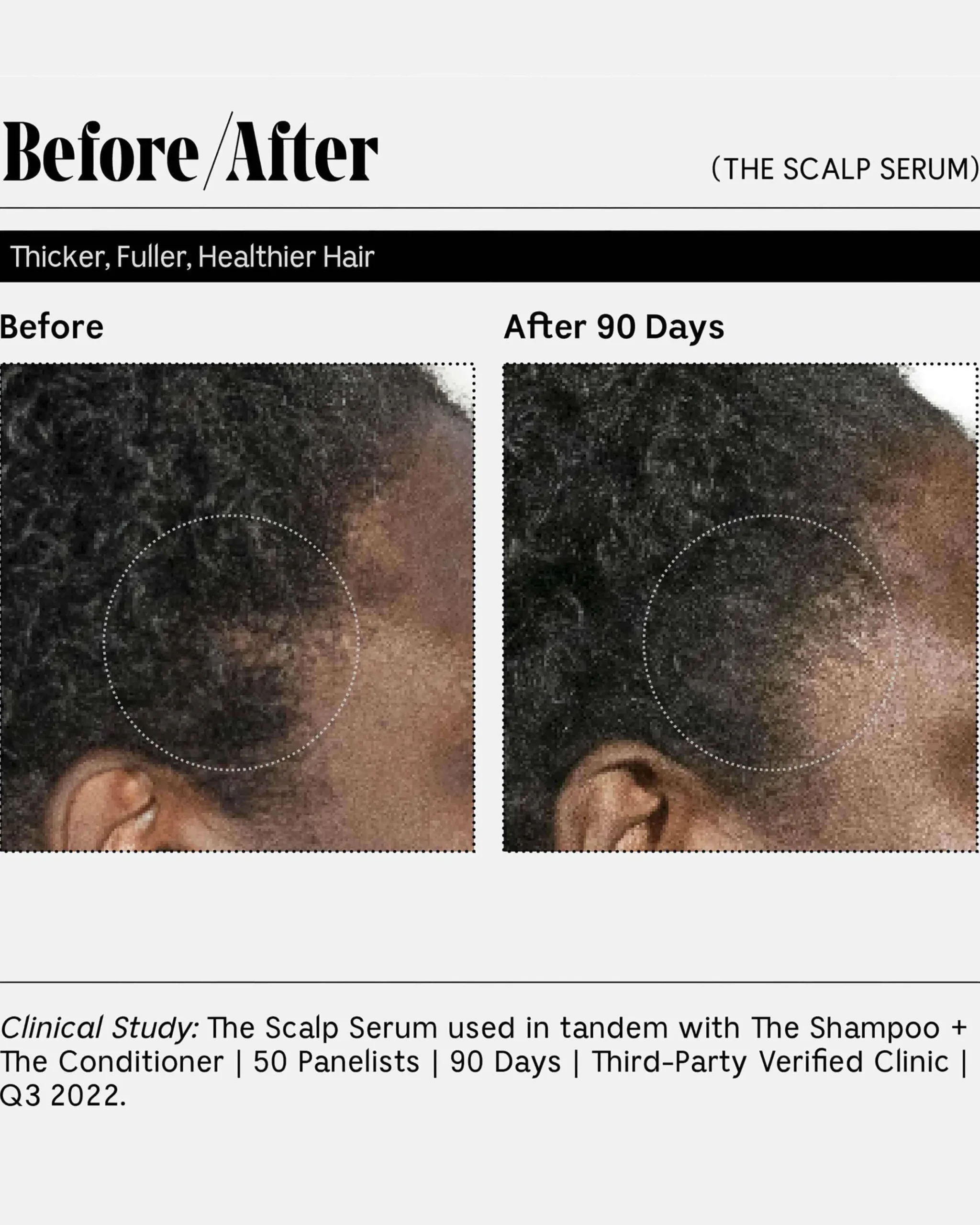 The Scalp Serum