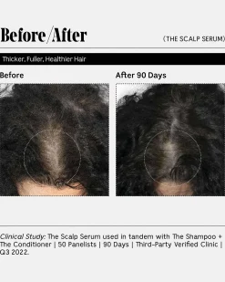 The Scalp Serum