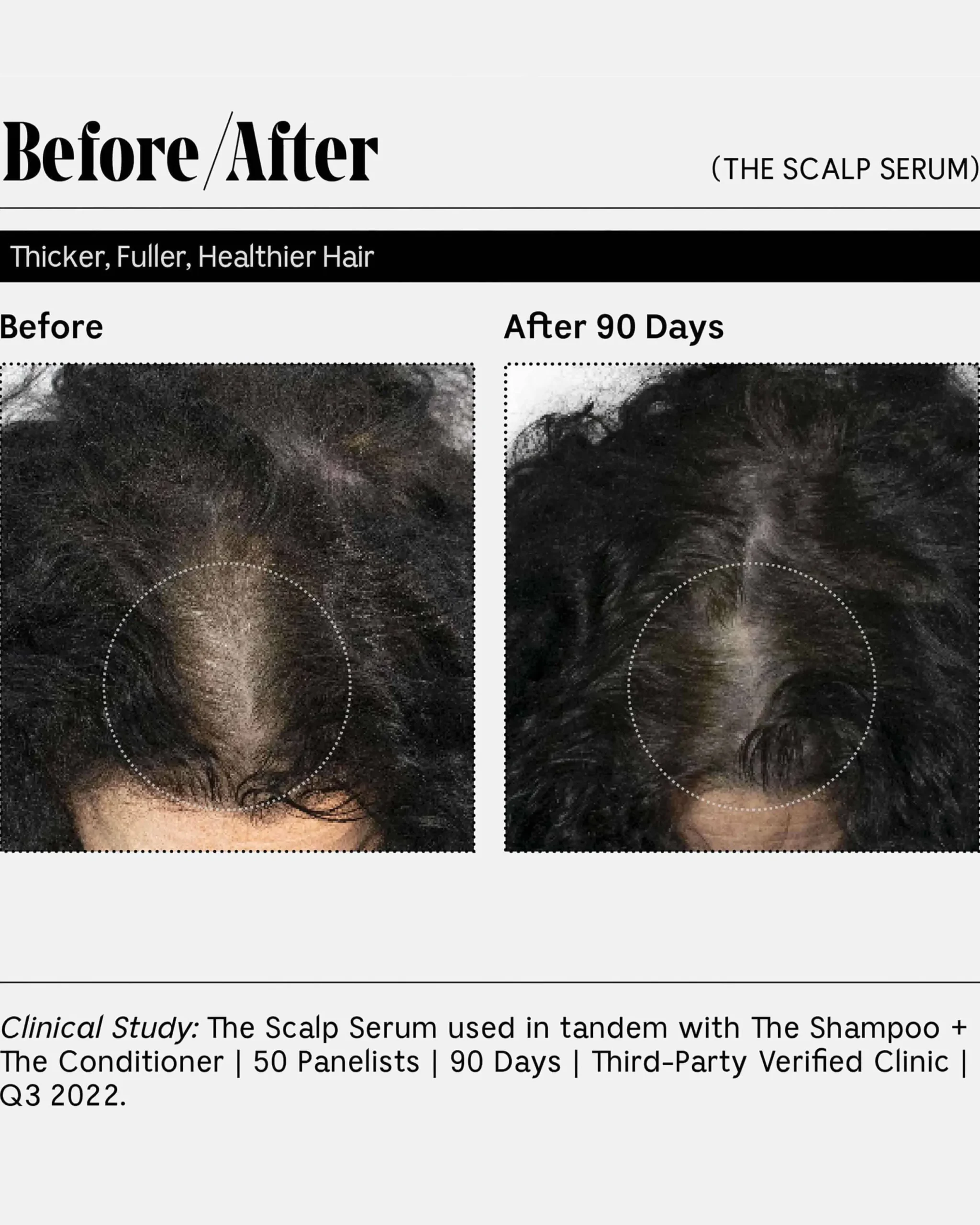 The Scalp Serum