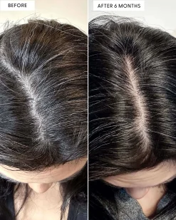 To The Root Serum